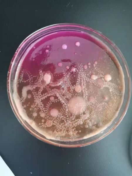 显微镜下的守卫者 食品微生物检测中的常见菌类识别